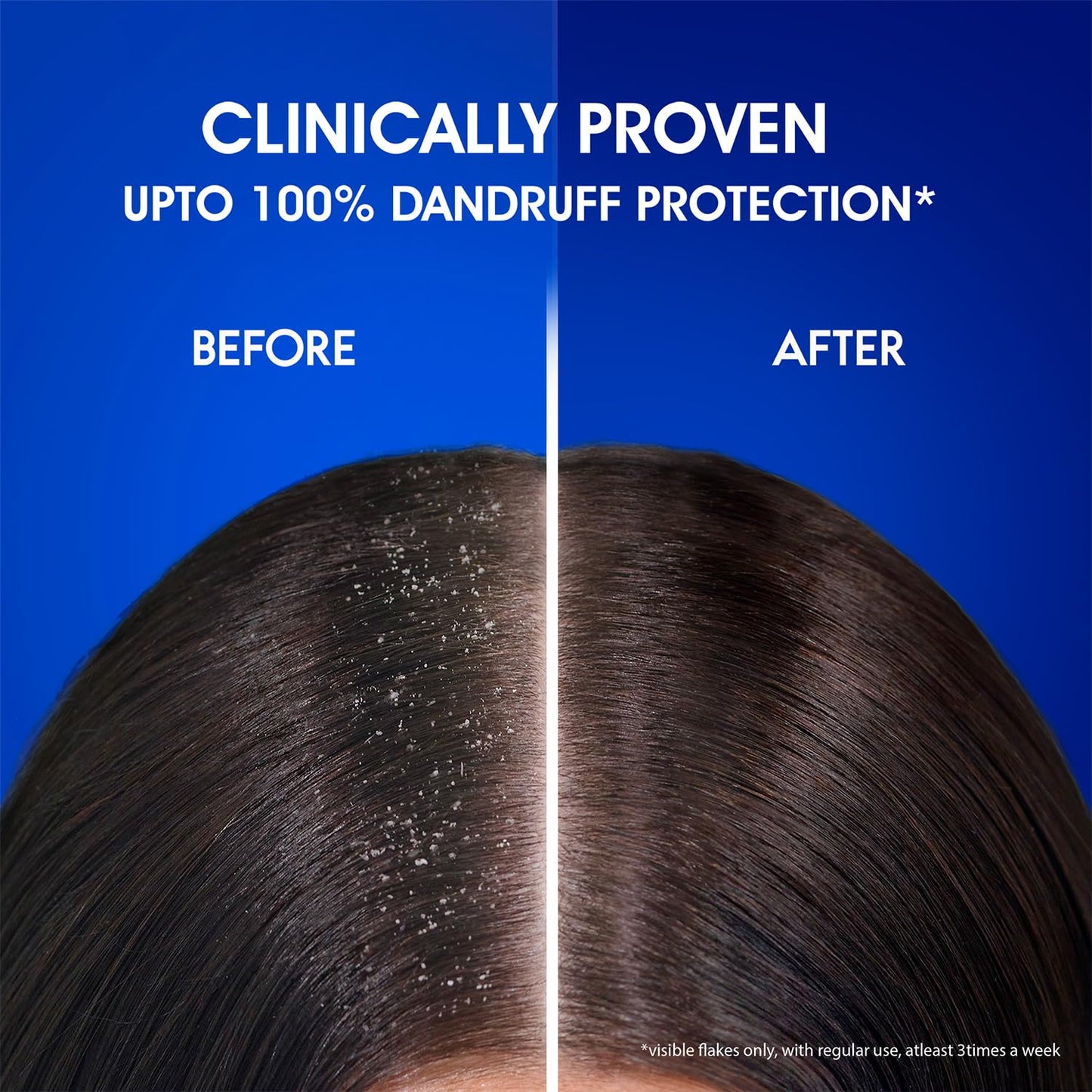 H&S Anti-Dandruff Shampoo Smooth&Silk 180ml, 340ml